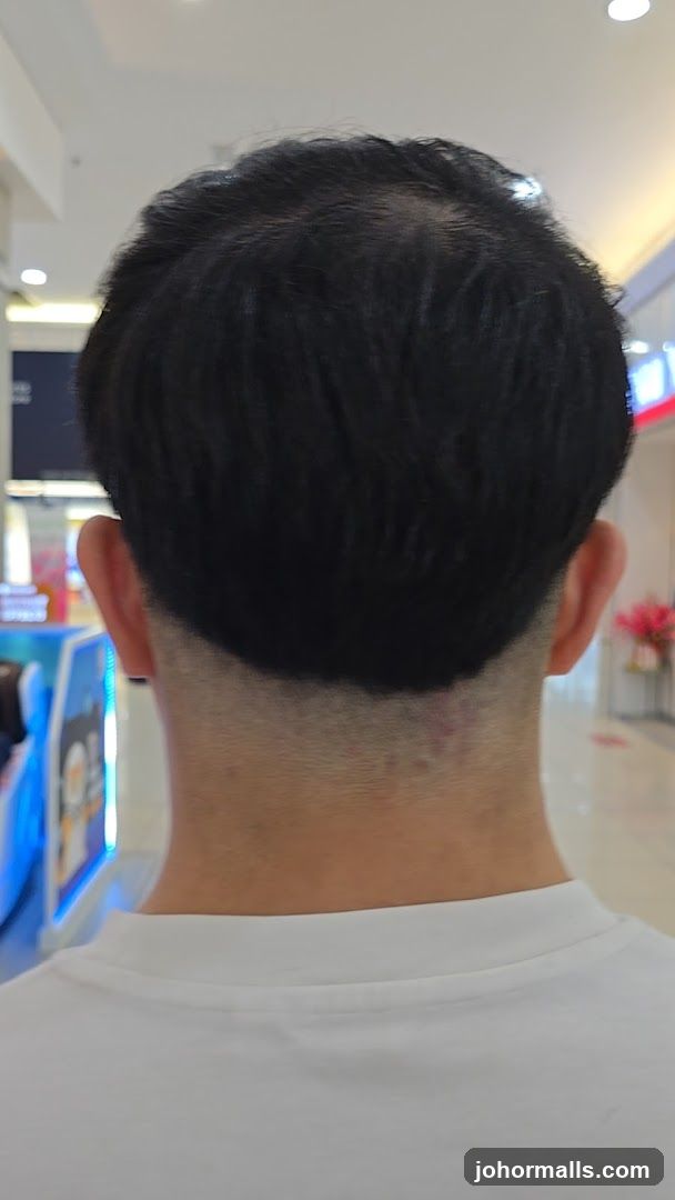 Back of Head and Neck