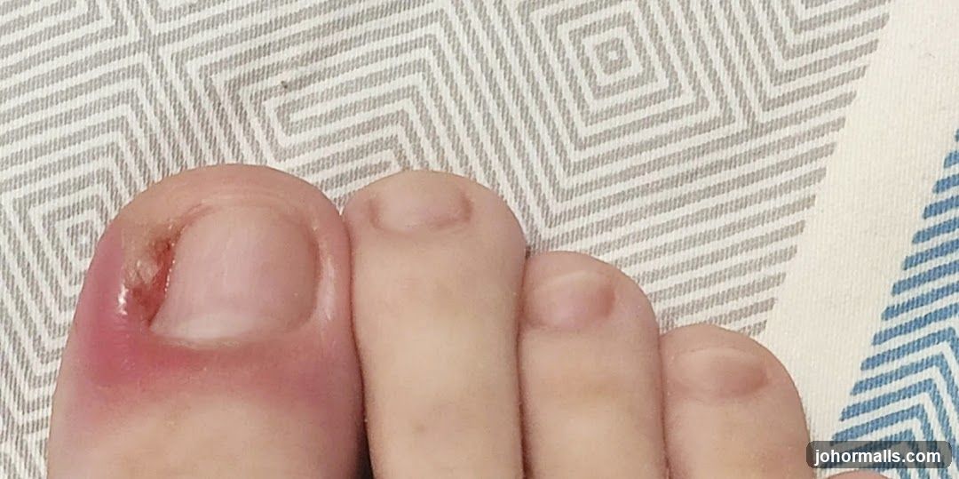 Foot with Infection